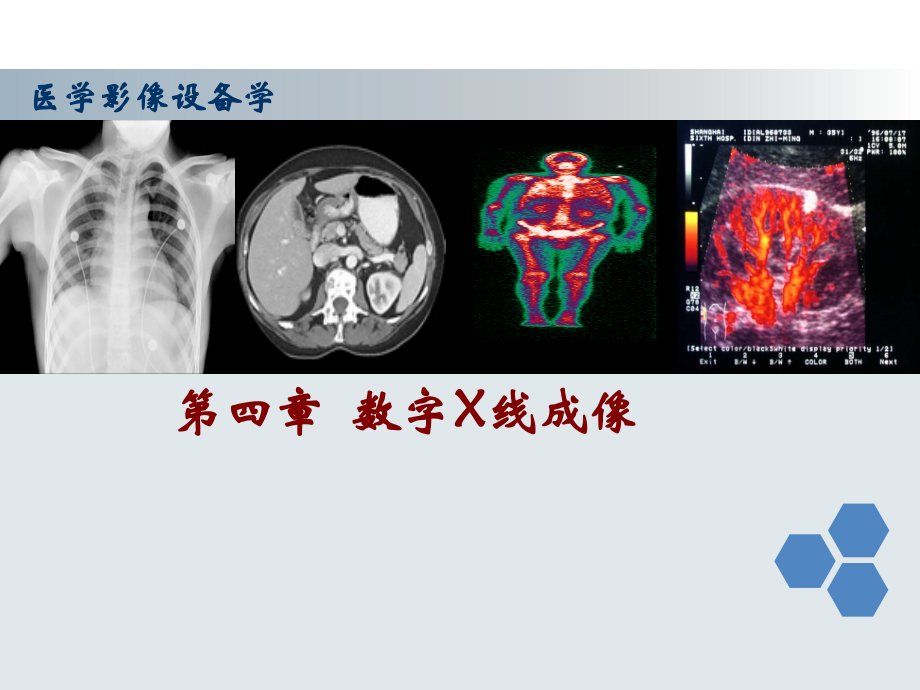 第四章-数字X线成像-DR.pptx_第1页
