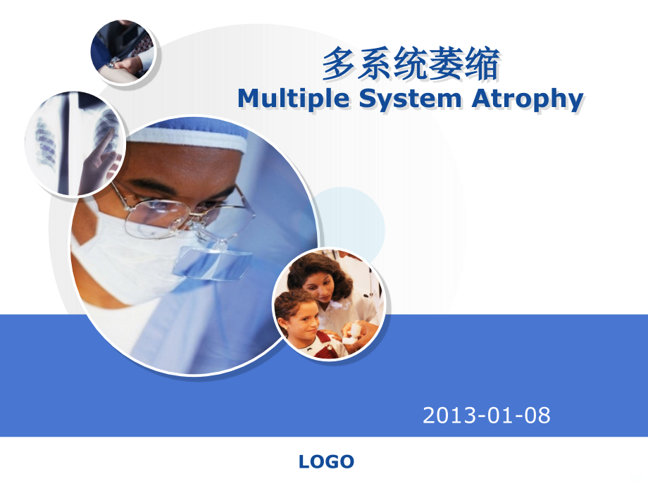 MSA多系统萎缩PPT课件.ppt_第1页