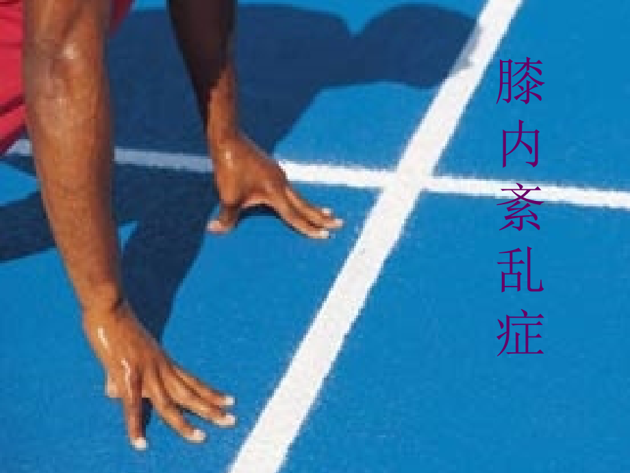 股四头肌对于膝关节损伤的重要性.ppt_第2页