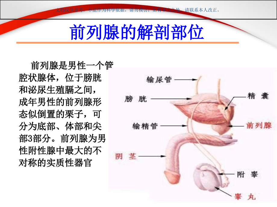 经尿道前列腺等离子电切术.ppt_第2页