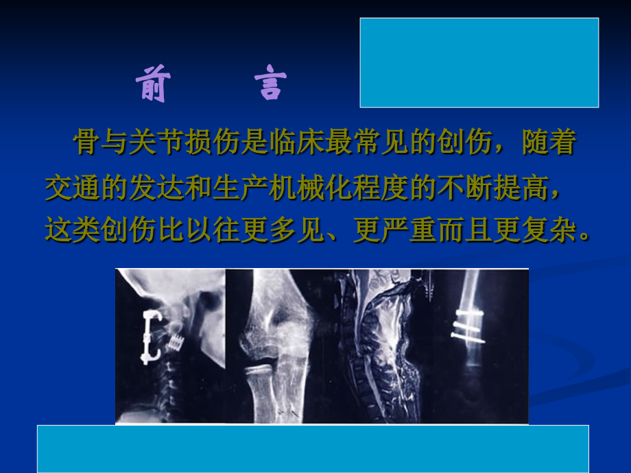 骨与关节损伤的早期处理.ppt_第2页