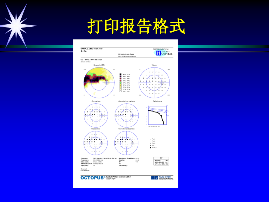 视野图的阅读.ppt_第2页