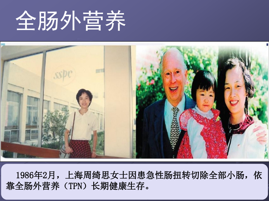 全肠外营养.ppt_第2页
