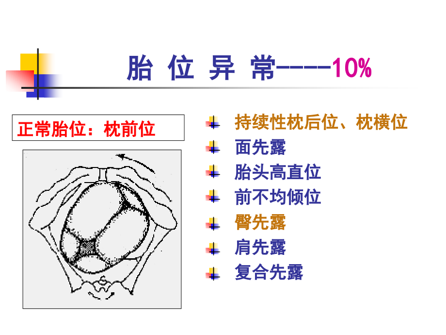 胎 位 异 常.ppt_第2页