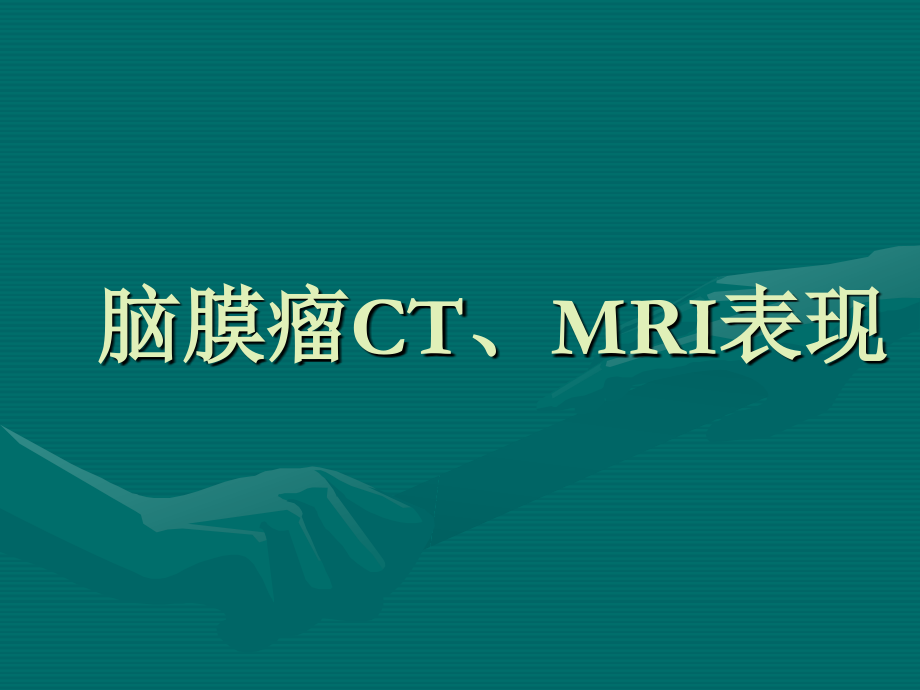 脑膜瘤CT、MRI表现.ppt_第1页