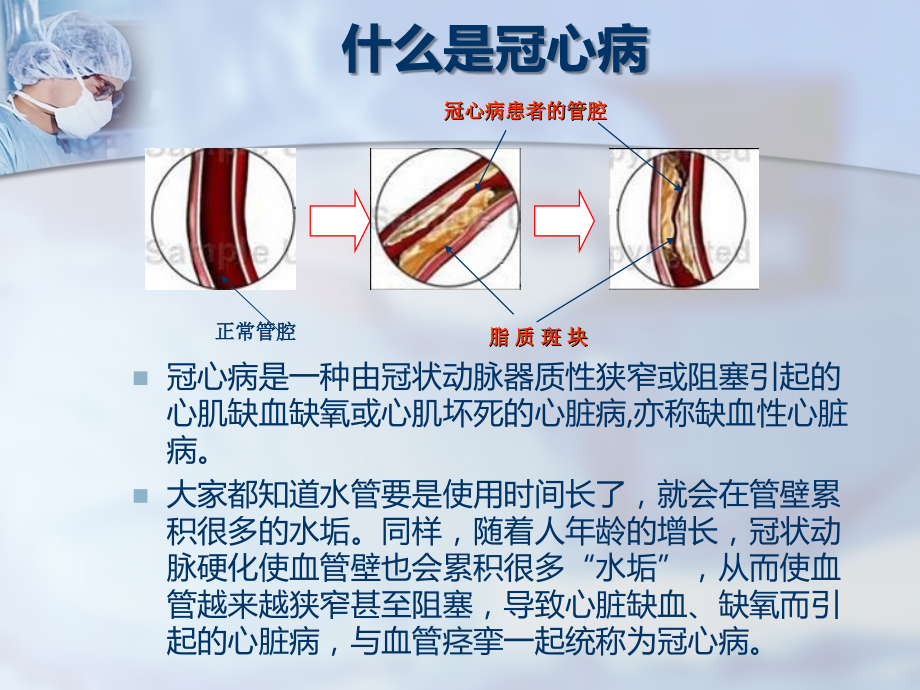 冠心病心绞痛的防治.ppt_第2页
