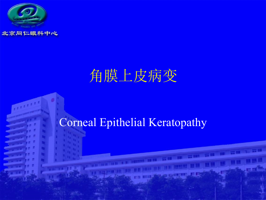 角膜上皮病变.ppt_第1页