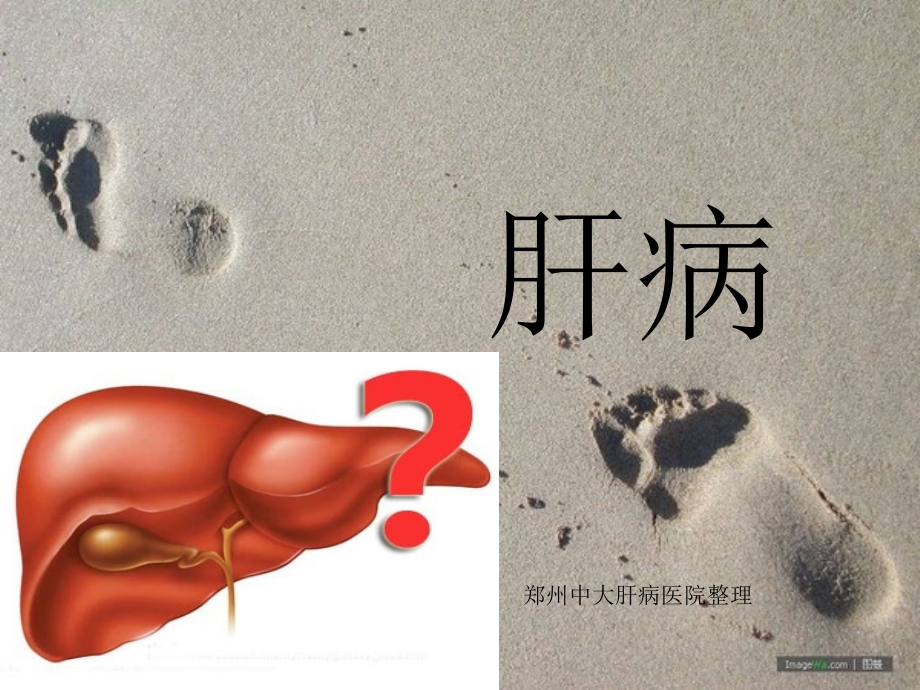慢性病之肝病_郑州肝硬化治疗医院.ppt_第1页