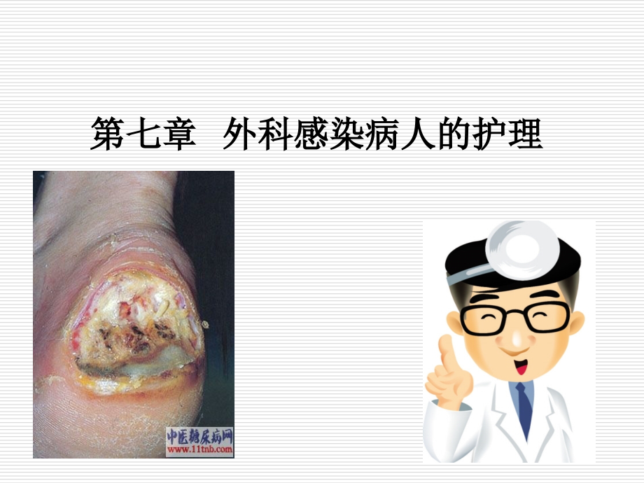 第七章_外科感染病人的护理.ppt1.ppt_第1页