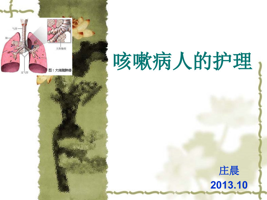 咳嗽病人护理.ppt_第1页