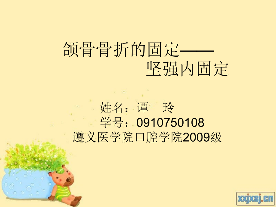 颌骨骨折固定.ppt_第1页