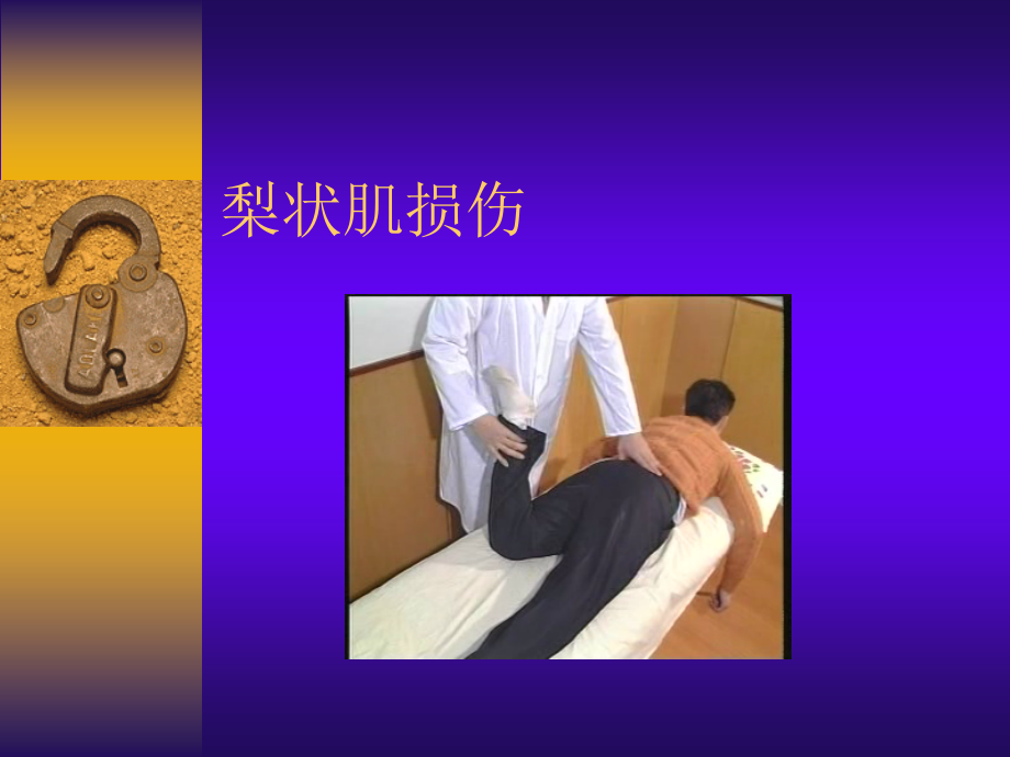 梨状肌损伤.ppt_第1页