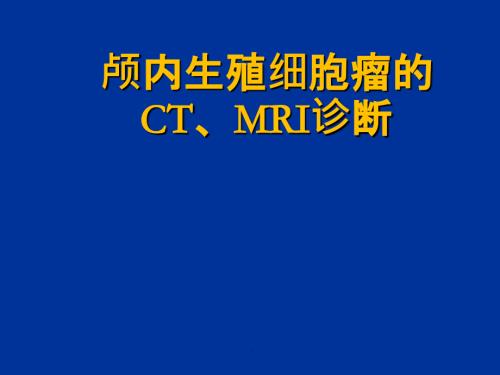 颅内生殖细胞瘤影像诊断.pptx