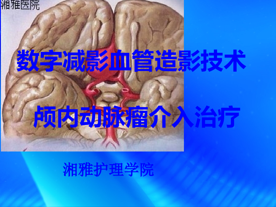 DSA+颅内动脉瘤介入治疗.ppt_第1页