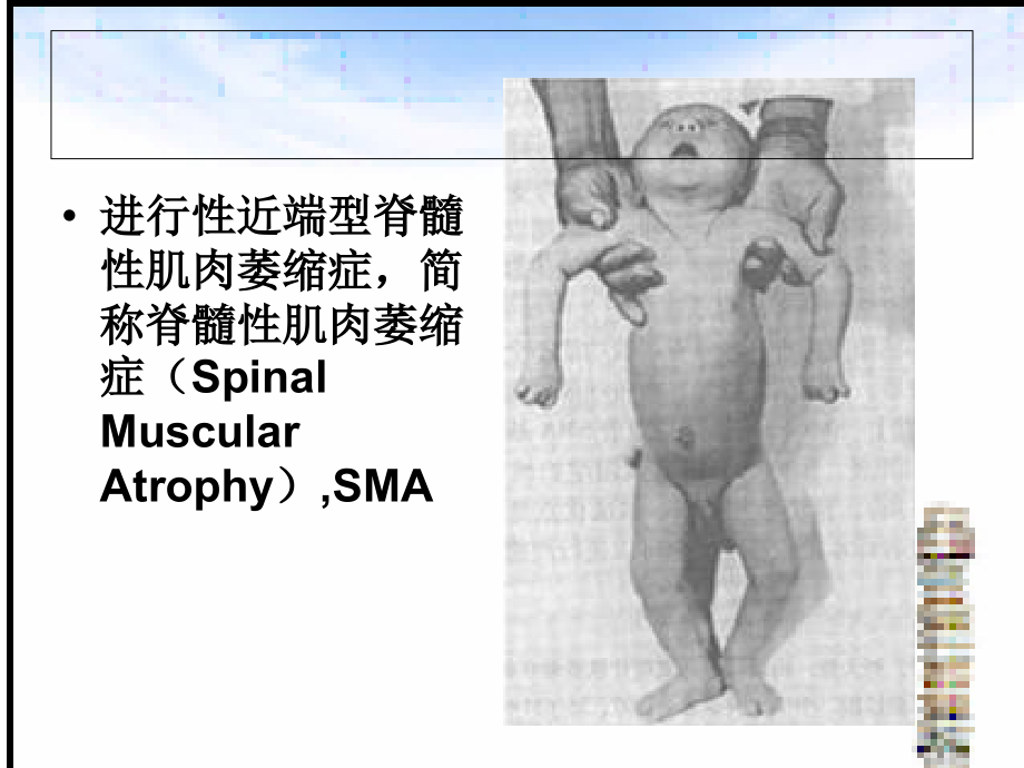 SMA分子检测进展.ppt_第2页