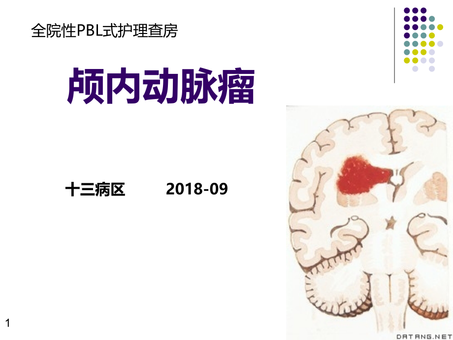 颅内动脉瘤PBL形式查房.pptx_第1页