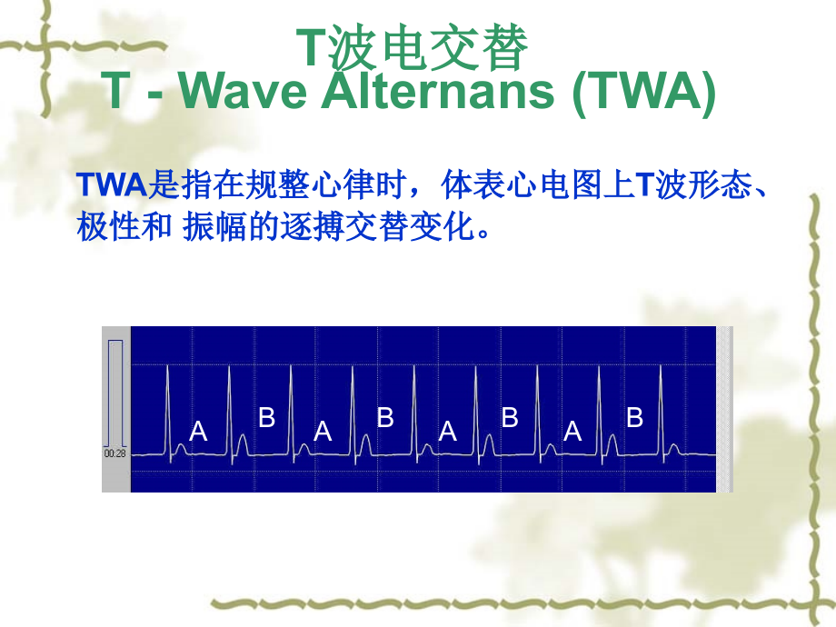 T 波电交替.ppt_第2页