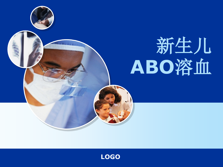 新生儿ABO溶血2.ppt_第1页