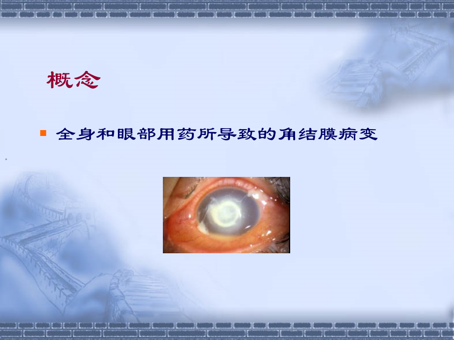 眼睑真菌病合并霰粒肿病一例.ppt_第2页