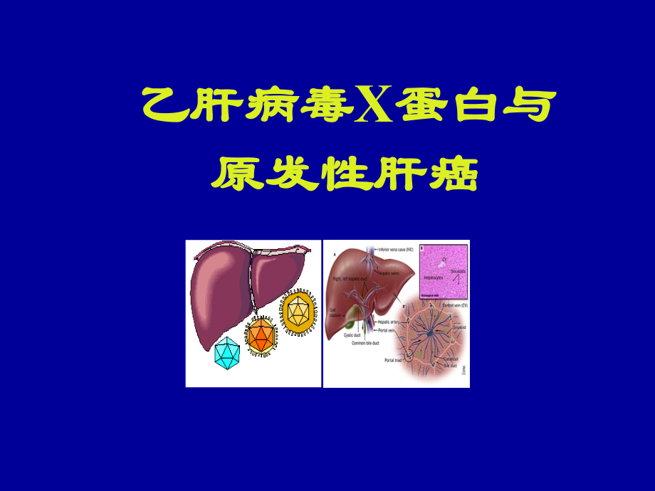 HBV-X-蛋白与原发性肝癌.ppt_第1页