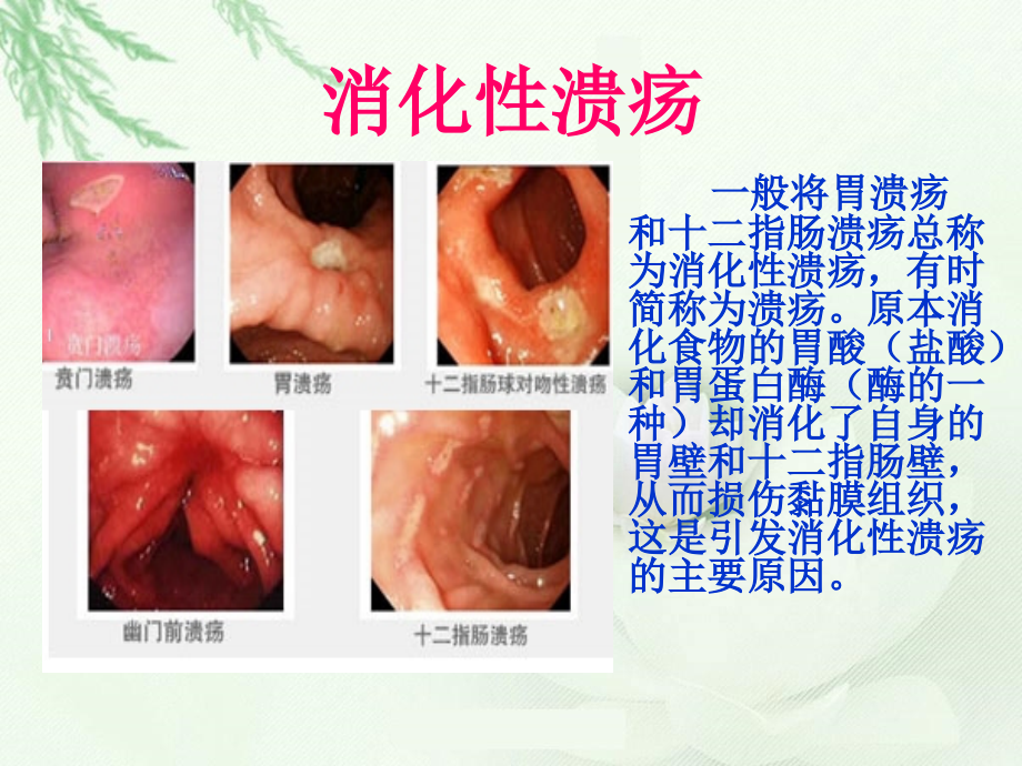 抗酸药-抑制胃酸分泌药.ppt_第2页