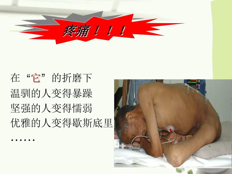 疼痛讲座.ppt_第2页