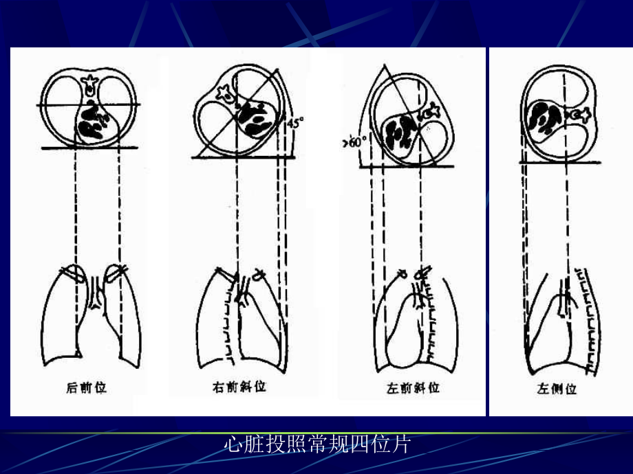 正常表现与基本病变.ppt_第2页