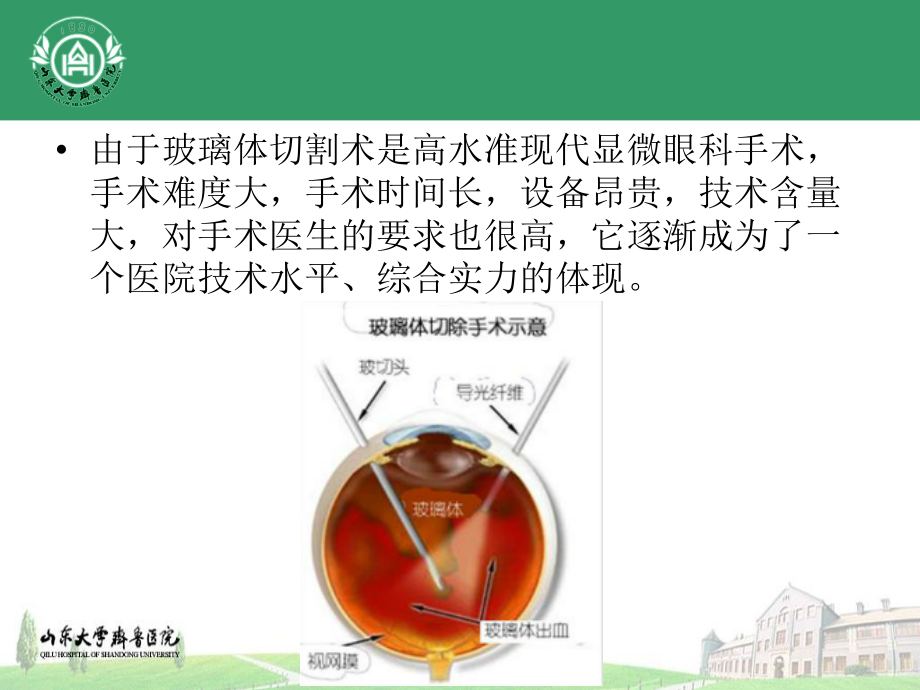 玻璃体切割术适应征.pptx_第2页