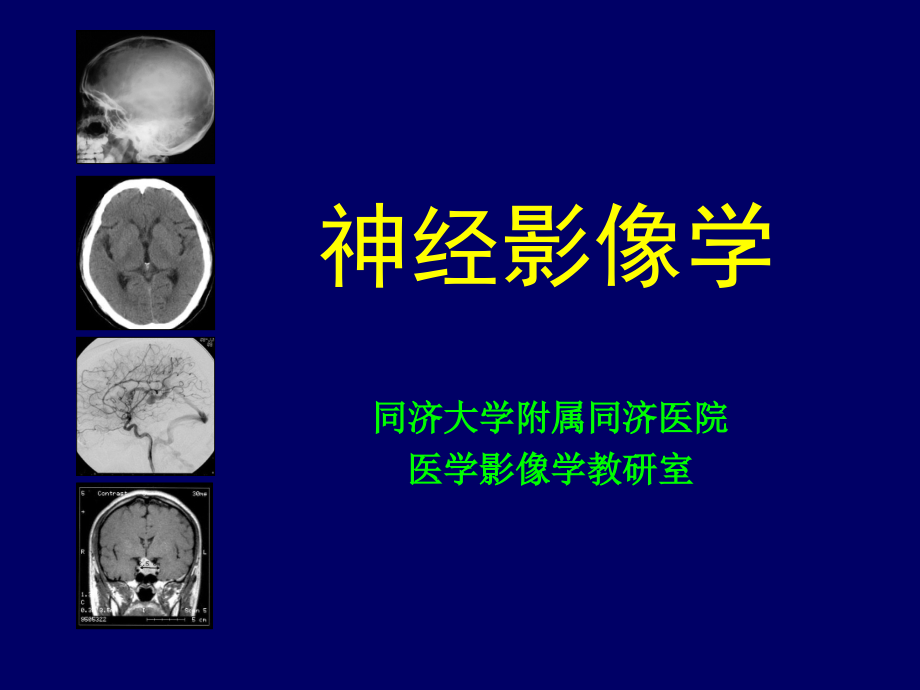 神经影像学--颅脑检查方法[1].ppt_第1页