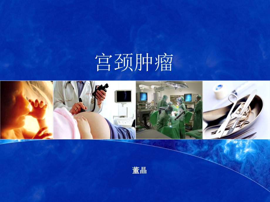 子宫肌瘤的分类.ppt_第1页