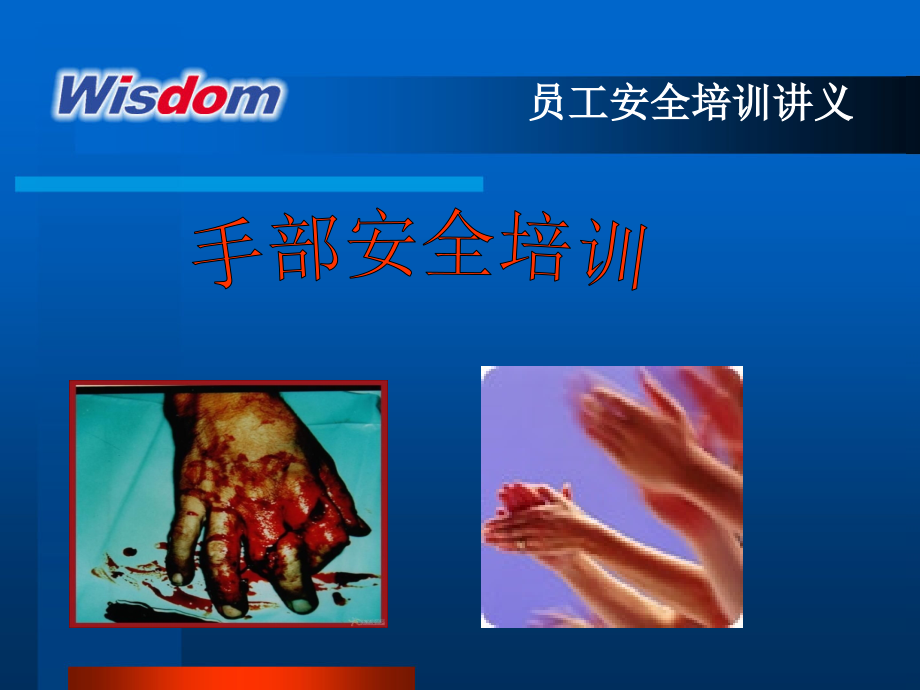 杜绝手部伤害.ppt_第2页