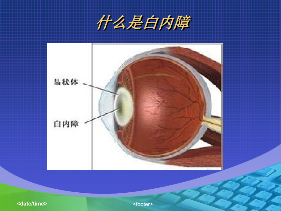 外伤性白内障.ppt_第2页
