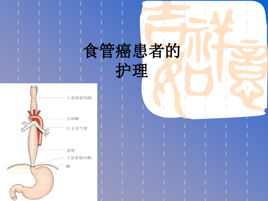 食管癌患者的.ppt_第1页