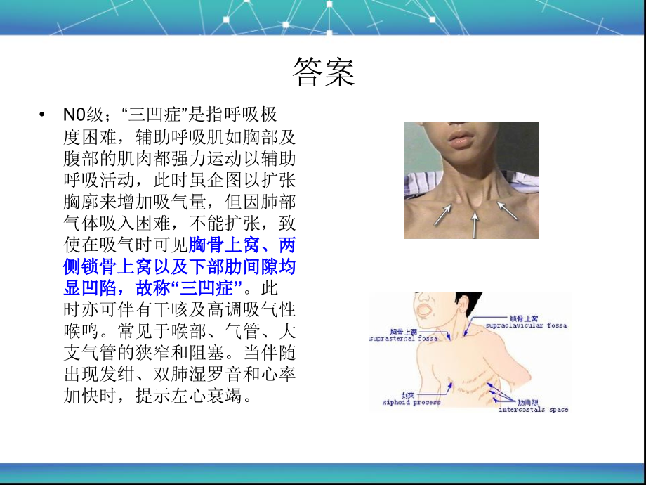 喉梗阻-Microsoft-PowerPoint-幻灯片.ppt_第2页