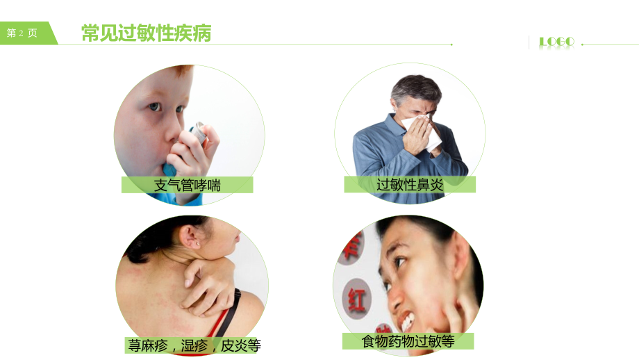 支气管哮喘-过敏性鼻炎-荨麻疹.pptx_第2页