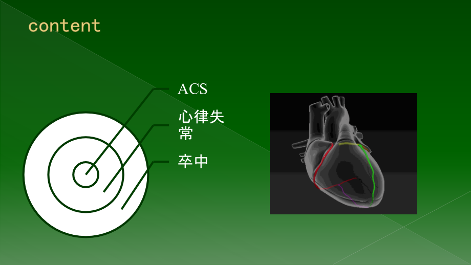 ECCM心脑血管急症——研究生教材.pptx_第2页