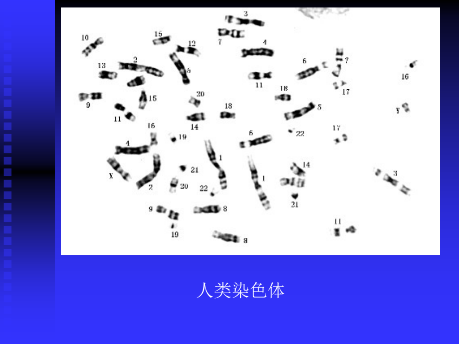 人类染色体和染色体病.ppt_第2页