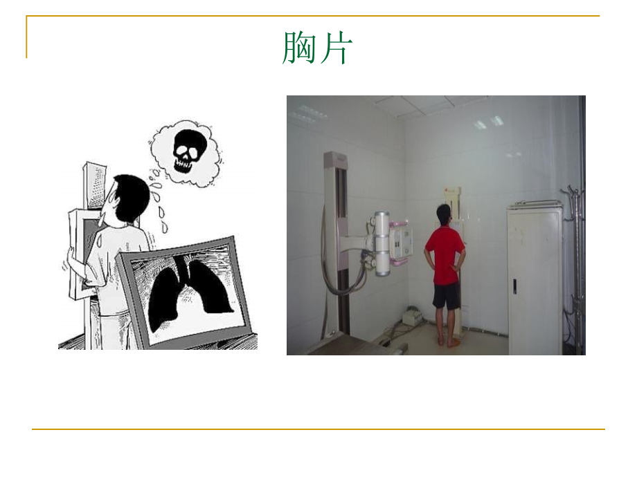 呼吸科X线、CT带教(正常、基本病变均包含).ppt_第2页