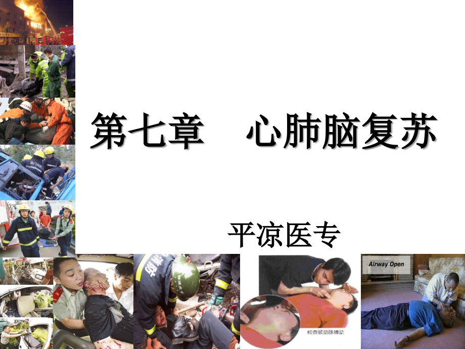 急救CPCI描述.ppt_第1页