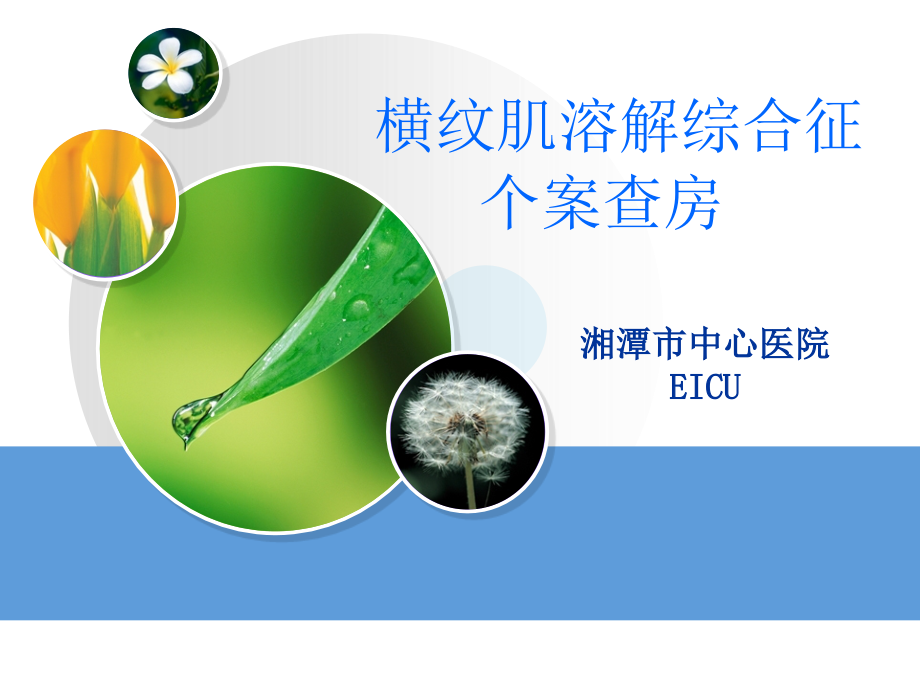 横纹肌溶解综合征个案查房-(1).ppt_第1页
