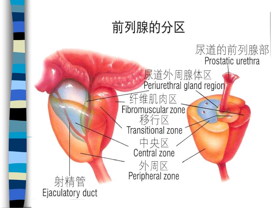 慢性前列腺炎-和男性不育.ppt_第2页