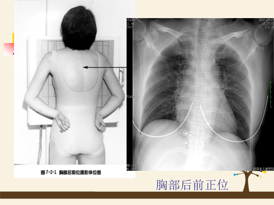 呼吸、循环、消化、泌尿影像学.ppt_第2页