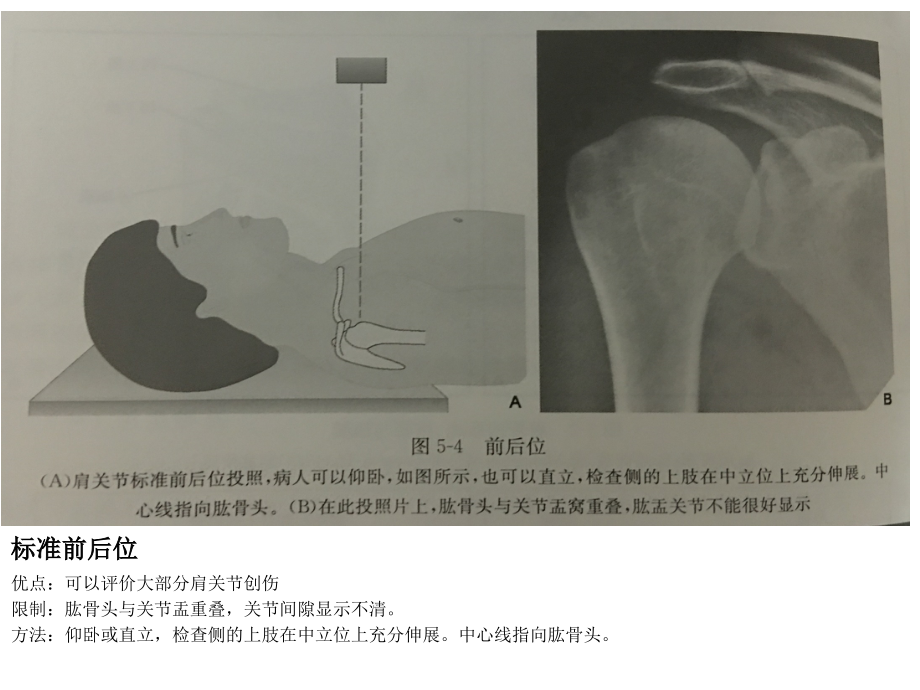 不同肩关节X线投照位.ppt_第2页