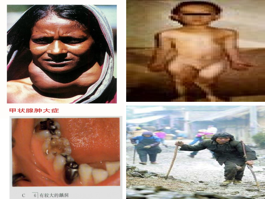化学元素与人体健康..ppt_第2页