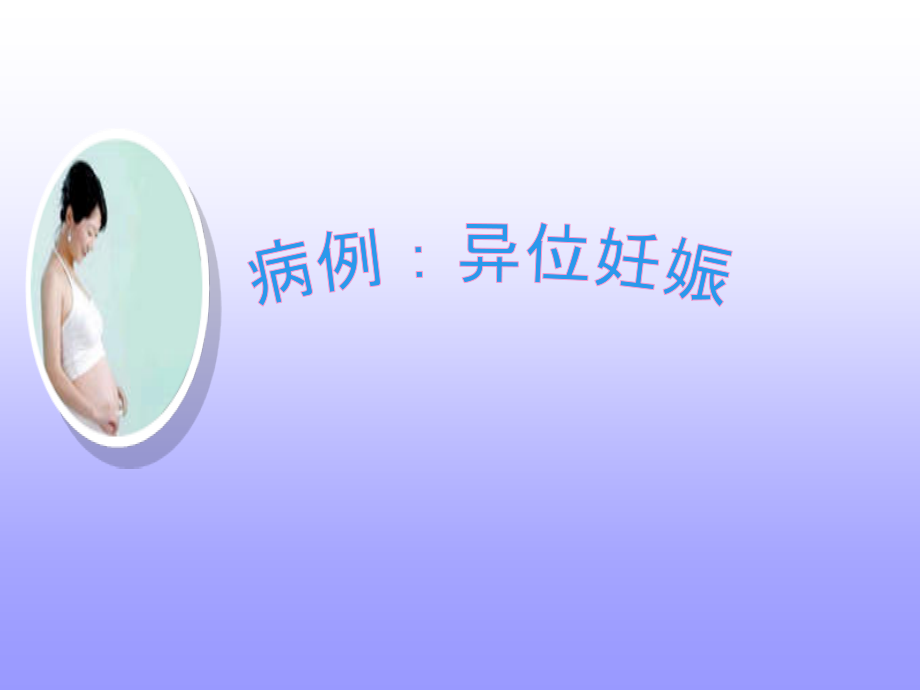 异位妊娠病例讨论ppt.ppt_第1页