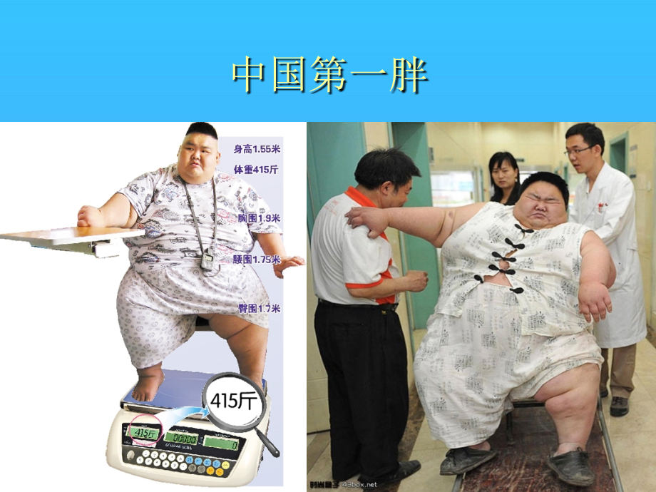肥胖的危害与防治优秀.ppt_第2页