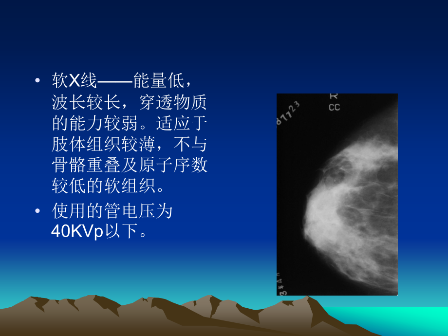 乳腺钼靶摄影.ppt_第2页