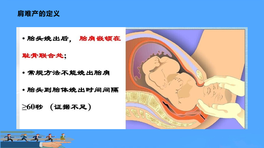 肩难产的紧急处理.pptx_第2页