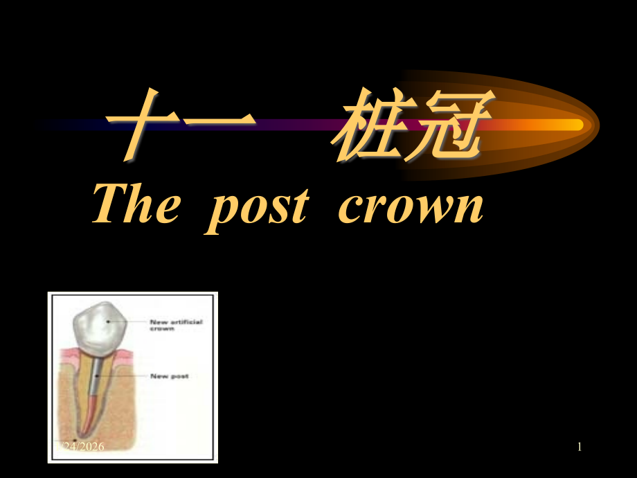 桩冠课件07.ppt_第1页