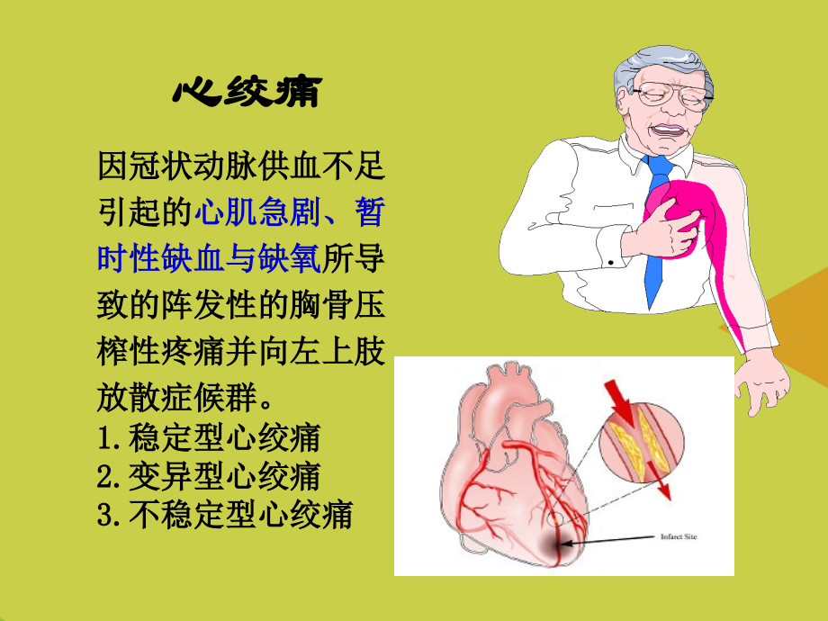 抗心绞痛与调血脂药.ppt_第2页